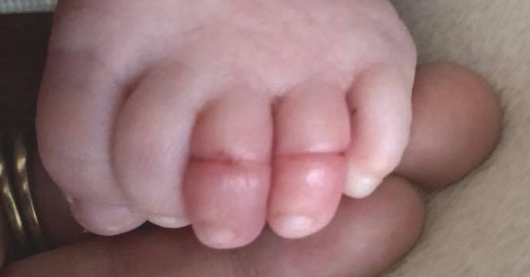 Wanhopige moeder waarschuwt alle ouders om de tenen van hun baby te…