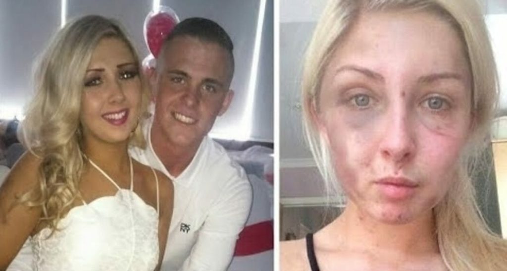 19-jarig meisje 4 uur lang geslagen omdat ze haar vriendje geen sigaret wilde geven