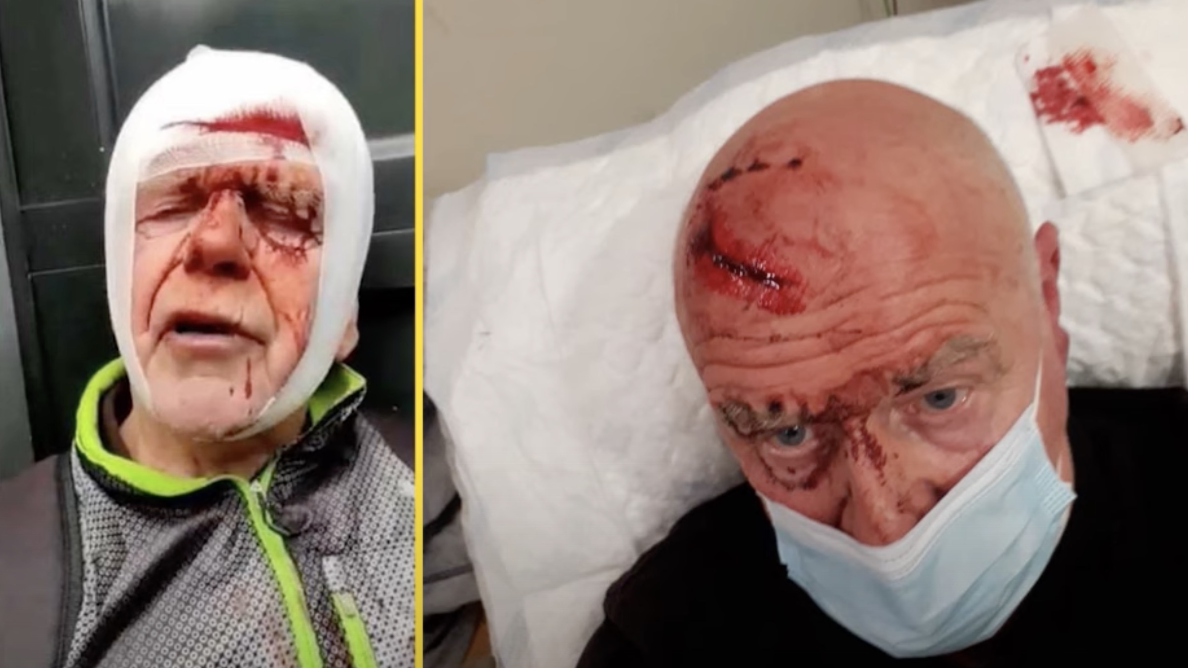 71-jarige bejaarde man tot bloedens toe geslagen door politie op Museumplein
