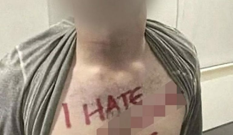 ‘Ik haat n****s’ op student zijn borst getekend – weigert excuses te maken