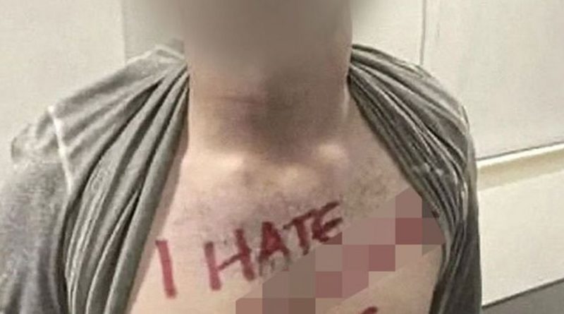 ‘Ik haat n****s’ op student zijn borst getekend – weigert excuses te…