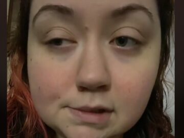 Lyndsi (28) is allergisch voor zwaartekracht: ''Ik kan maximaal 3 minuten staan''