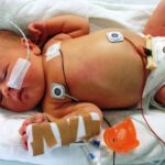 Ouders van ernstig zieke baby weigeren levensreddende ingreep om bizarre reden