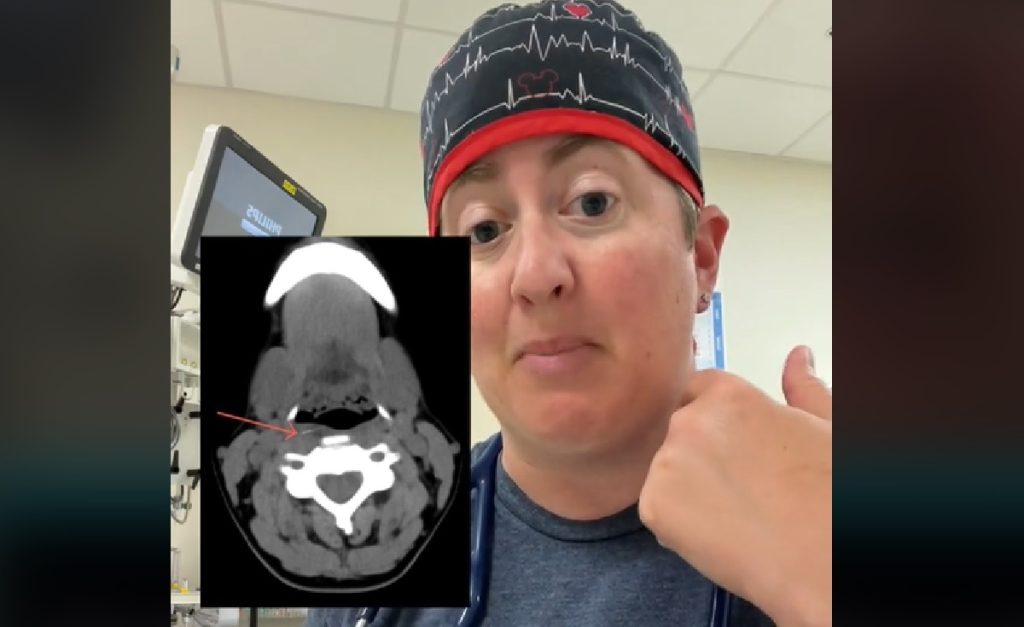Dokter doet vreselijke ontdekking na scan bij jongetje (4) met oorpijn