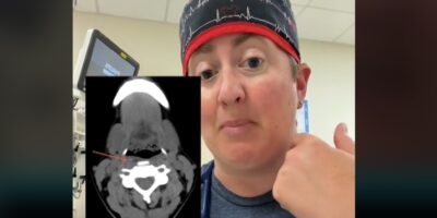 Dokter doet vreselijke ontdekking na scan bij jongetje (4) met oorpijn