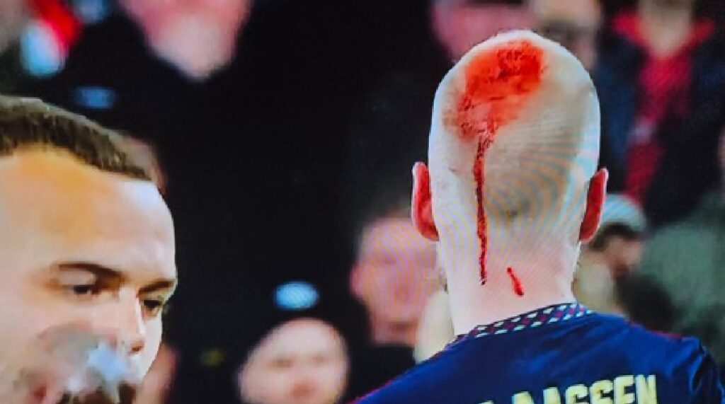 Ajax-speler Davy Klaassen zwaargewond tijdens Klassieker