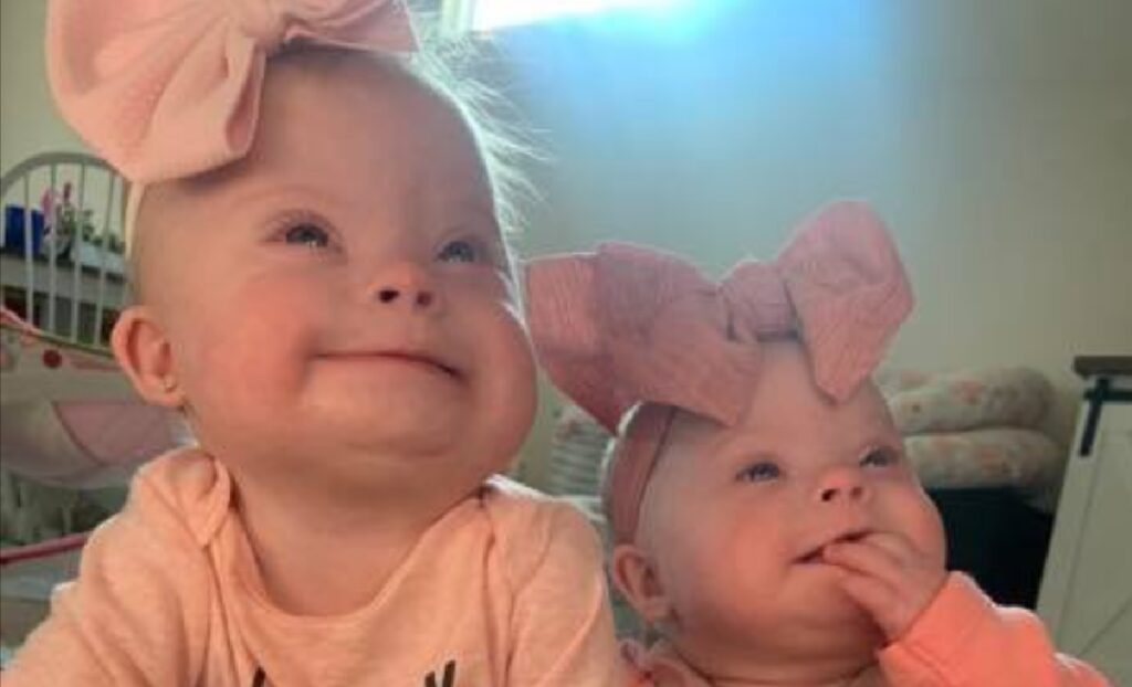 Moeder van zeldzame tweeling met Down toont hoe prachtig en kostbaar ze zijn
